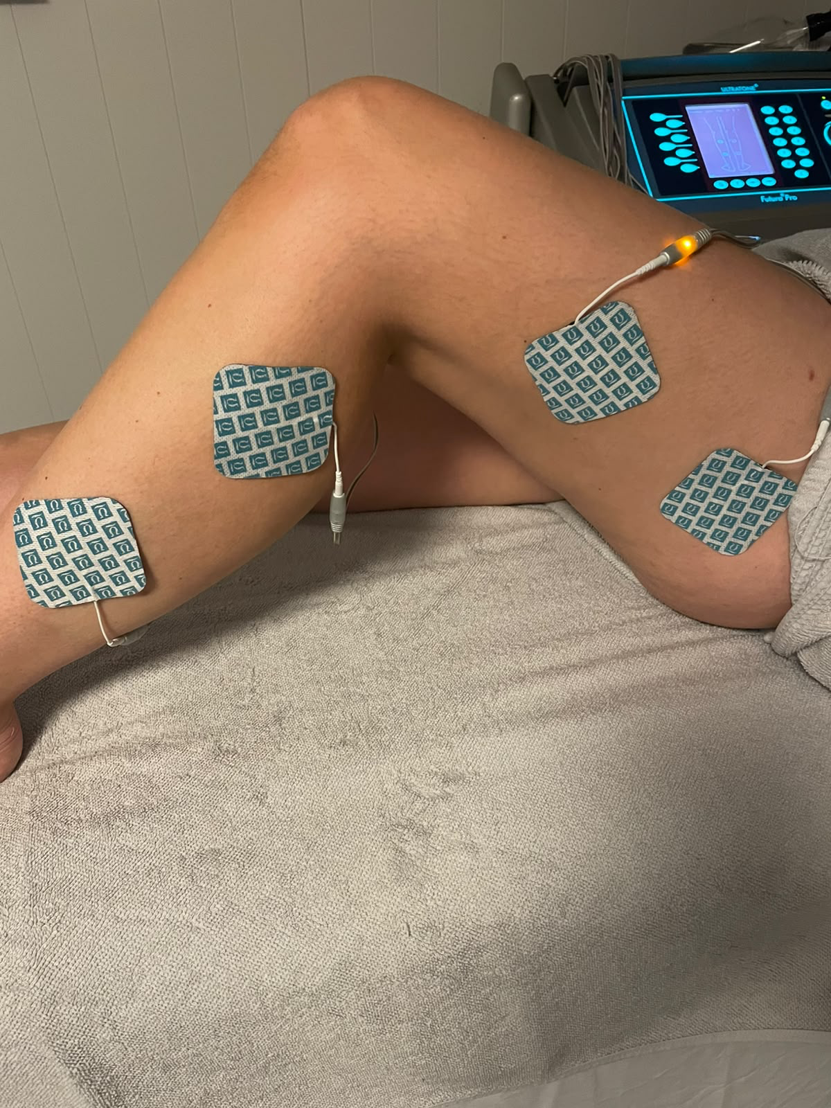 Lymfedrenasje med Ultratone og elektroder på beina